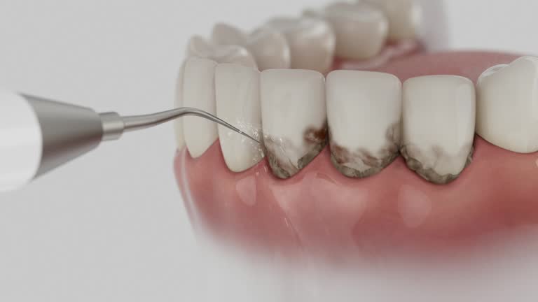 Trusted Teeth Cleaning And Checkup service in Monteagle, TN - Dentist Open Now
